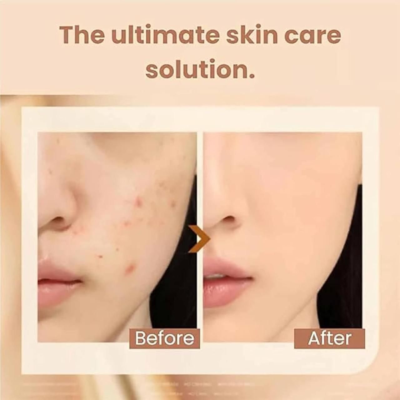 Foundation Stick