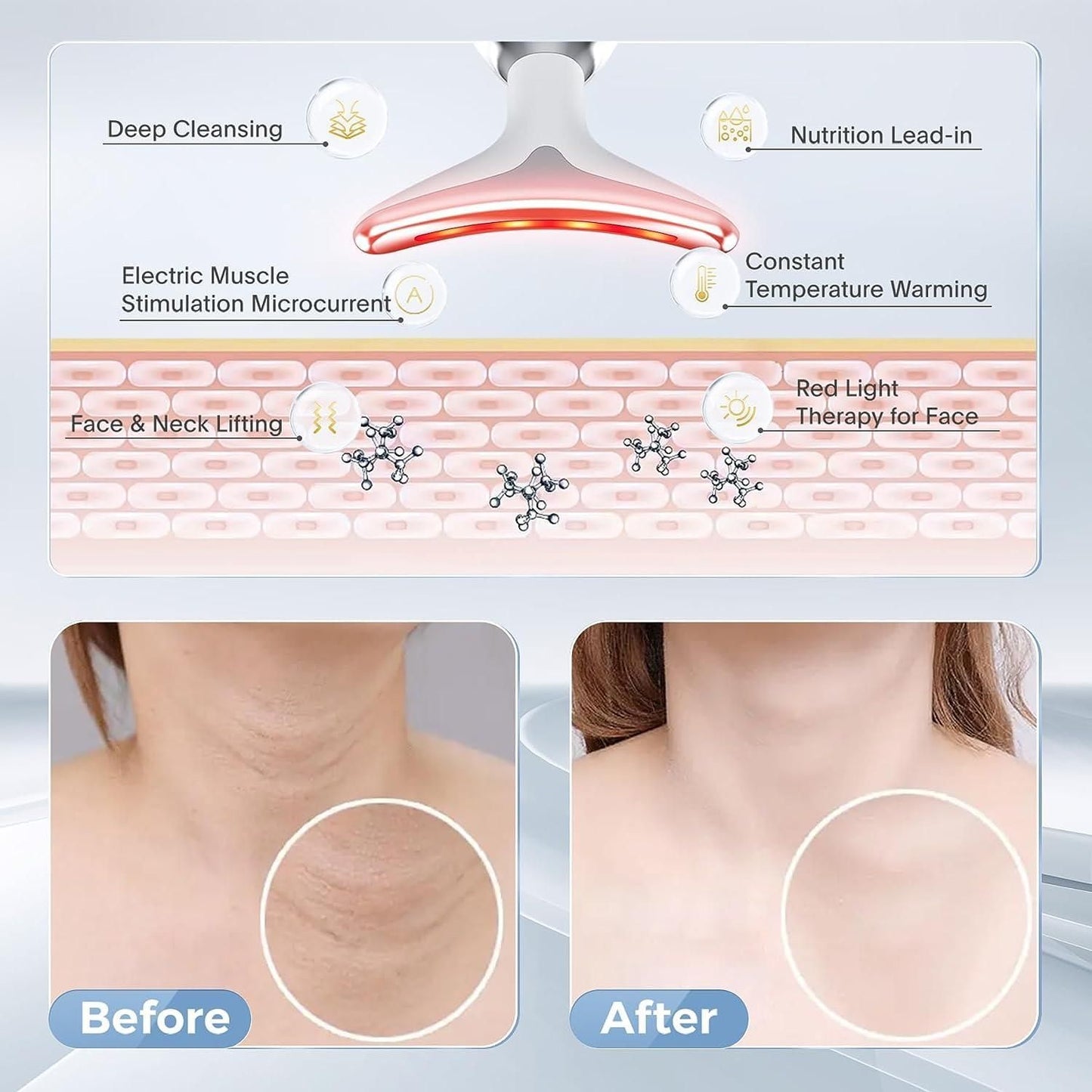 face lifting device