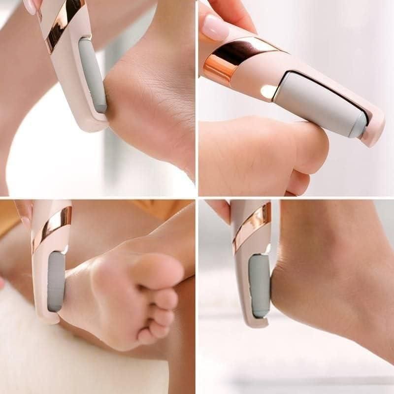callus remover for feet
