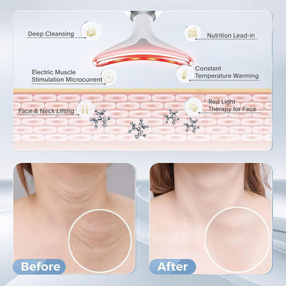 face lifting device